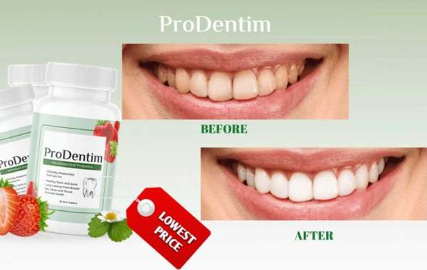 ProDentim Australia Health Reviews – Pros, Cons, Uses Benefits!