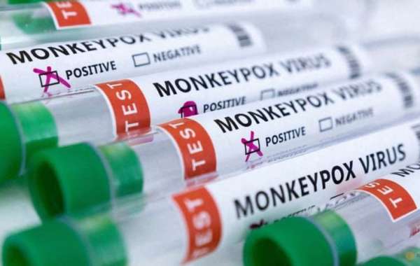 Don't touch foreigners to reduce monkeypox risk, says senior Chinese health official