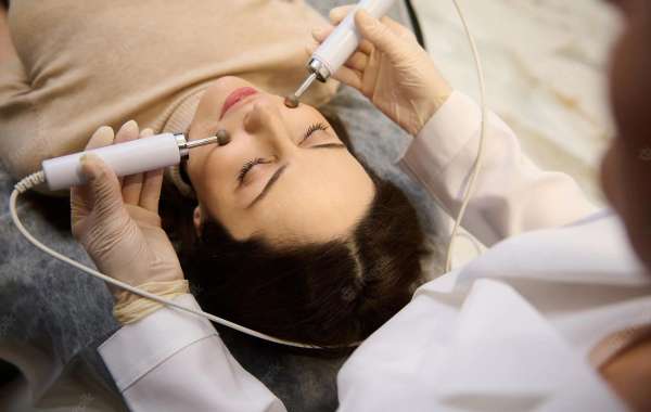 Microdermabrasion London, Ontario for Beautiful Skin