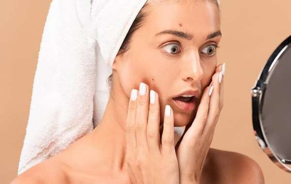 Reasons Why Your Acne Is Getting Worse