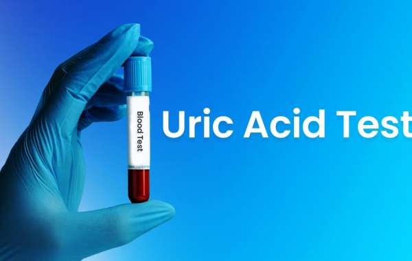 Uric Acid Test: Your Key to Unlocking Joint Health and Beyond