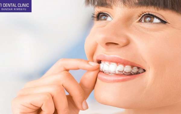 Teeth Veneers: Enhancing Your Smile with Precision and Care