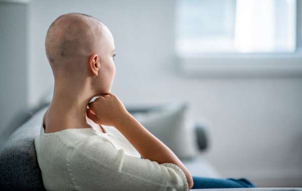 4 Things To Ask About Cancer And Hair Loss