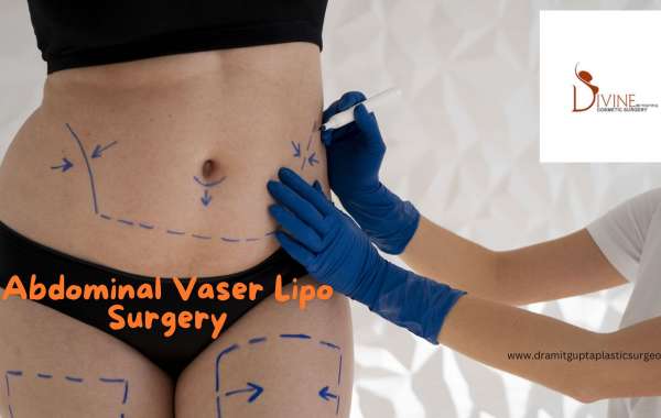 Tummy Transformation: Dr. Amit Gupta's Expertise in Abdominal Vaser Lipo