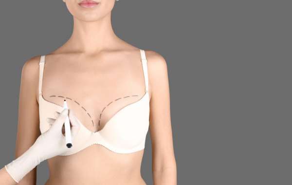 Exploring the Various Types of Breast Augmentation Surgeries
