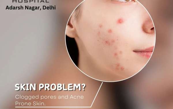 Don't Let Skin Stress You Out! Get Glowing at GTK Hospital in Adarsh Nagar, Delhi