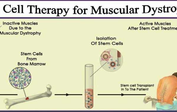 Muscular Dystrophy Treatment in India- All You Need To Know