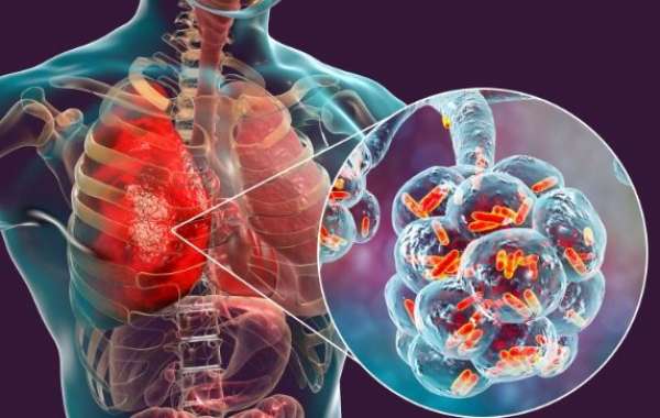 Azithromycin for Respiratory Infections: A Comprehensive Guide