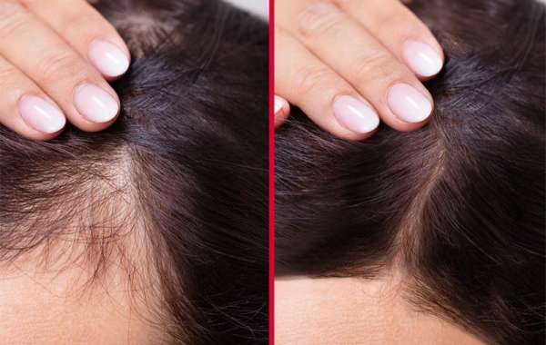 Restore and Shine The Ultimate Guide to Picking the Right Hair Serum for Damaged Hair