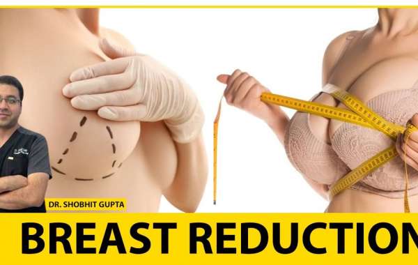 Is Breast Reduction Surgery Permanent?