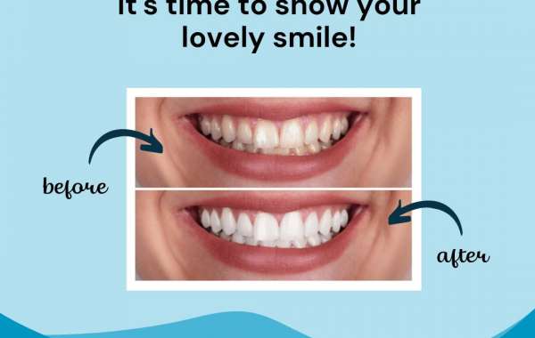 Best Dental Clinic in Vasant Kunj: Your Guide to Dental Arche