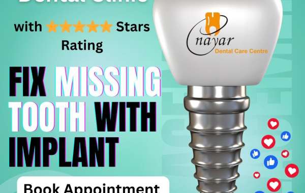 RCT Treatment Clinic in Noida: Why Nayar Dental is Your Best Choice