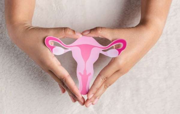 Effective Tips for Managing Prolapse of the Uterus