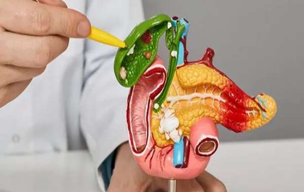 Bile Duct Cancer Drug Market Size, Outlook Research Report 2023-2032