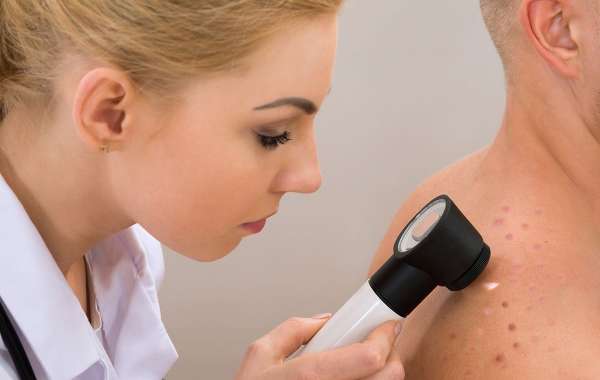 Skin Cancer Treatment Market Share, Trend, Segmentation and Forecast to 2030