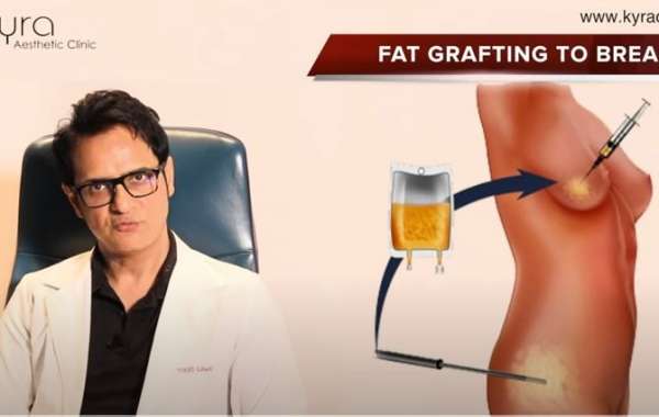 Fat Transfer to Breast Surgery in Ludhiana