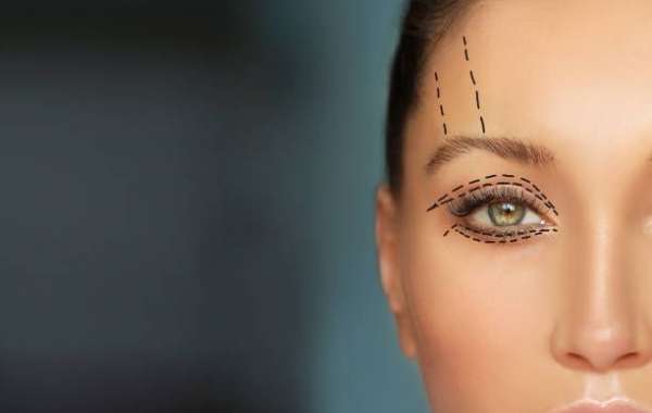 Lower Blepharoplasty Surgery: Under-Eye Solutions for a Youthful Look