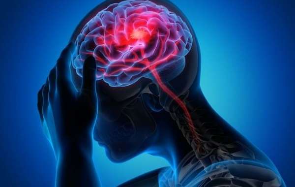 The Migraine Drugs Market: A 2024 Outlook