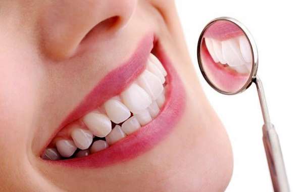 Arch Dental Woodbury Offers Teeth Whitening Services in Nassau County New York