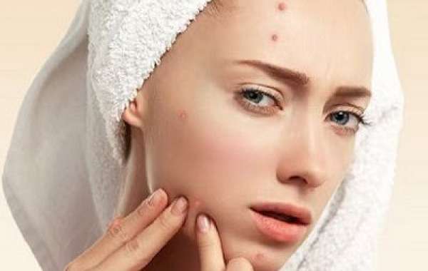 Reveal Clear, Smooth Skin with Acne Scar Removal