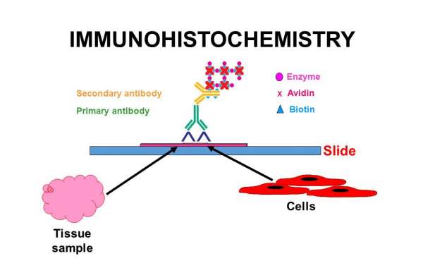 Immunohistochemistry Market Analysis, Key Players, Share Dynamic Demand and Consumption by 2024 to 2034