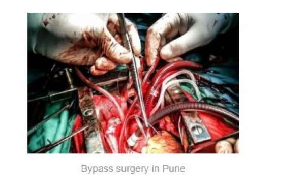 Heart surgery: Looking for reliable heart surgery? Dr. Ashish Dolas offers expert heart care with 1500 successful surger