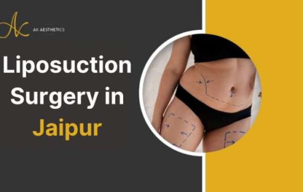 Smart Tips To Save Cost Of Liposuction Surgery