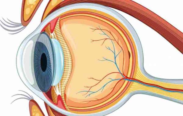 Best Microincision Cataract Surgery in Dubai by Dr. Vasu Kumar