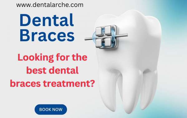 Best Dental Clinic in South Delhi: Discover Excellence at Dental Arche