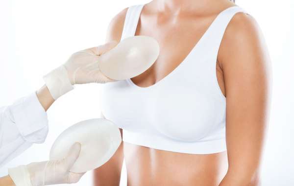 Understanding Breast Revision Surgery: What You Need to Know About the Procedure, Benefits, and Recovery