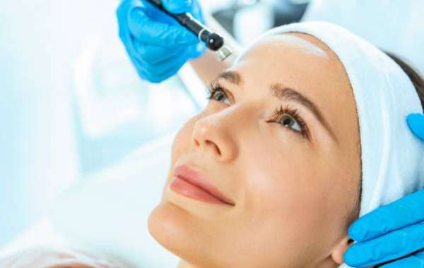 Benefits of SkinPen Microneedling for Flawless Skin