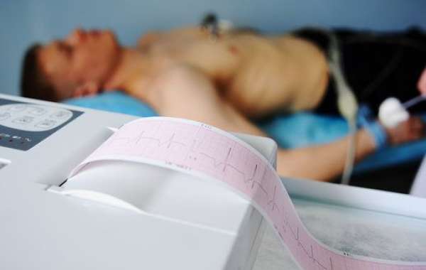 Comprehensive Insights on Prime Medical and the Cost for ECG Tests in Jamaica