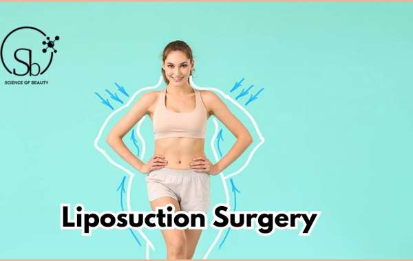 Frequently Asked Questions About Liposuction