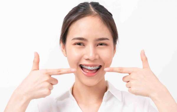 Quels Sont les Facteurs Clés de l'Esthétique Orthodontique ?