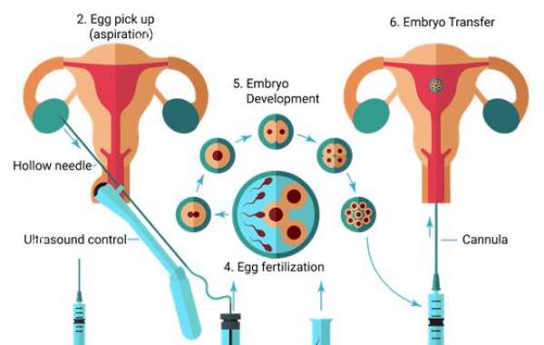 What Are the Benefits of IVF Treatments?