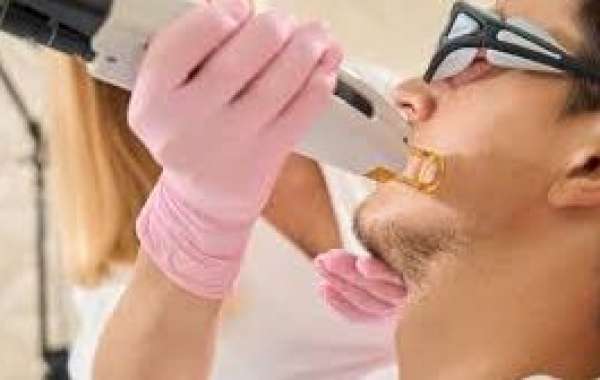 How Laser Hair Removal Works