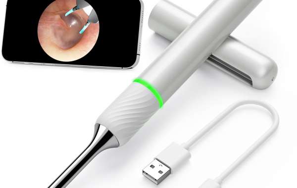 WHAT IS AN EAR CAMERA AND HOW CAN IT REVOLUTIONIZE EAR CARE?