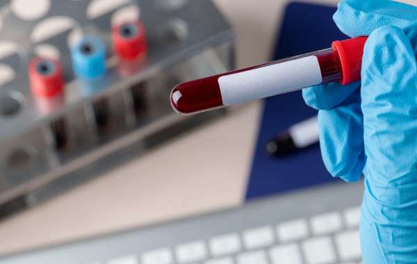 The Impact of Stress on Allergies: Can Blood Tests Detect It?