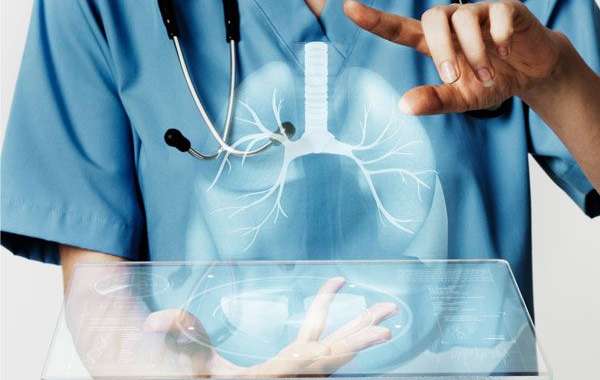 Why a Multidisciplinary Team Approach Matters in Lung Cancer Care
