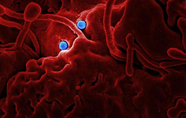 Next-Gen NASH Therapy: Madrigal's Rezdiffra Breakthrough Sets New Standards