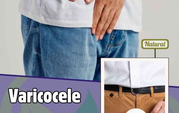 How to treat varicocele Natural  without surgery?
