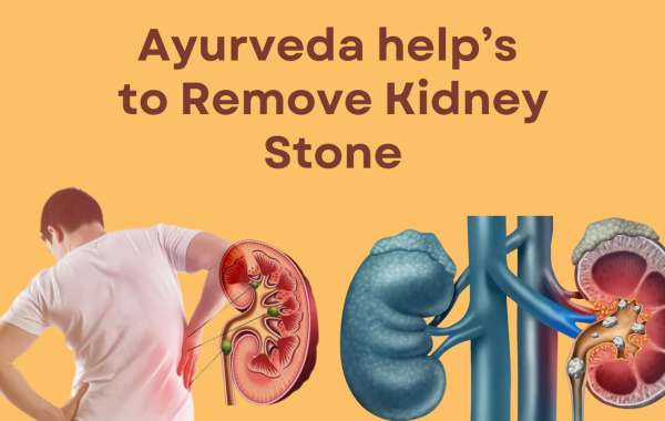 Kidney Stone Ayurvedic Solutions: SL-90 Renal Drop & Stone Removal Capsule