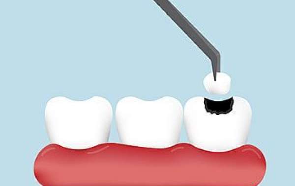 Master Your Skills with Hands-On Periodontal Courses at EduDent Academy UK