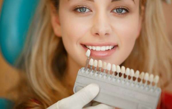 How To Pick The Best Veneers In Toronto For Your Smile