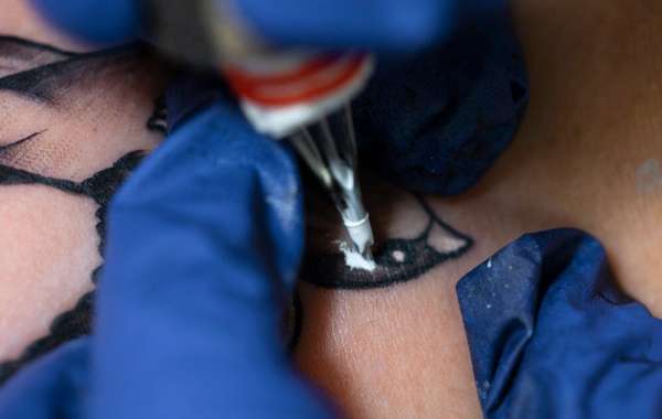 How Many Sessions Do You Need? London Experts Explain Laser Hair Removal Timelines
