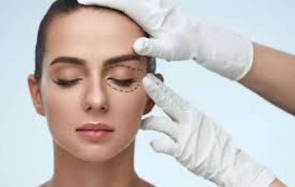 Eyelid Surgery in Dubai | Eyelid Surgeon in Dubai