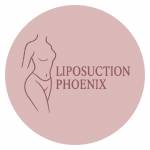 LiposuctionPhoenix09 Profile Picture