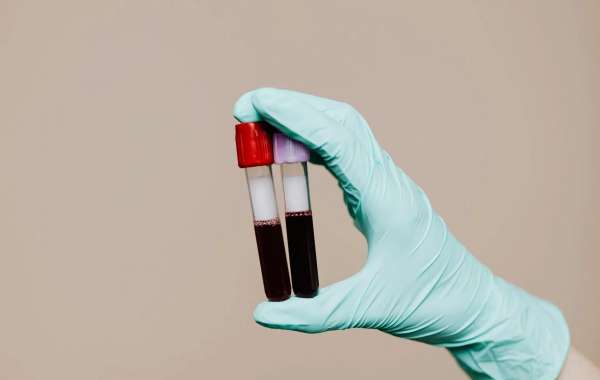 Hormone Balance Solutions with Nicolette E. DNP: Transform Your Health Naturally