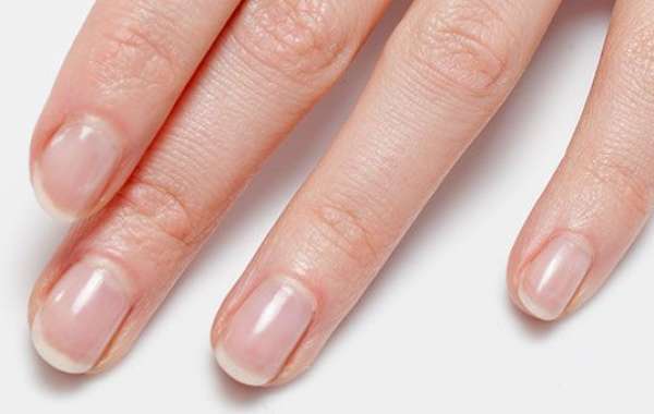 Verabschieden Sie sich von Nagelpilz mit Lumonail – schnell, sicher und effektiv!