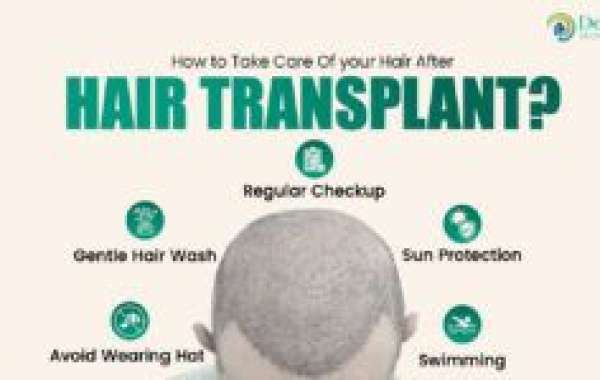 Hair Transplant for Advanced Baldness in Delhi: Grafts, Coverage, Cost & What to Expect